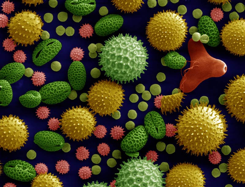 Pollen unter dem Rasterelektronenmikroskop